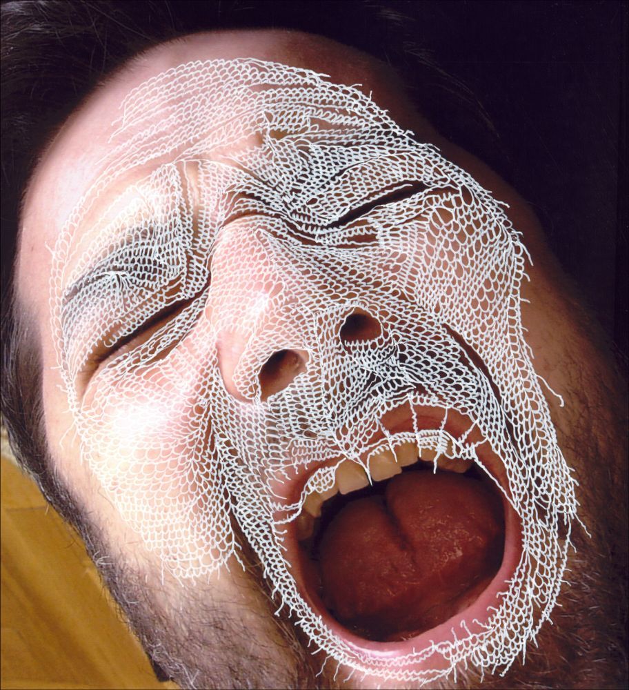 Castration 
